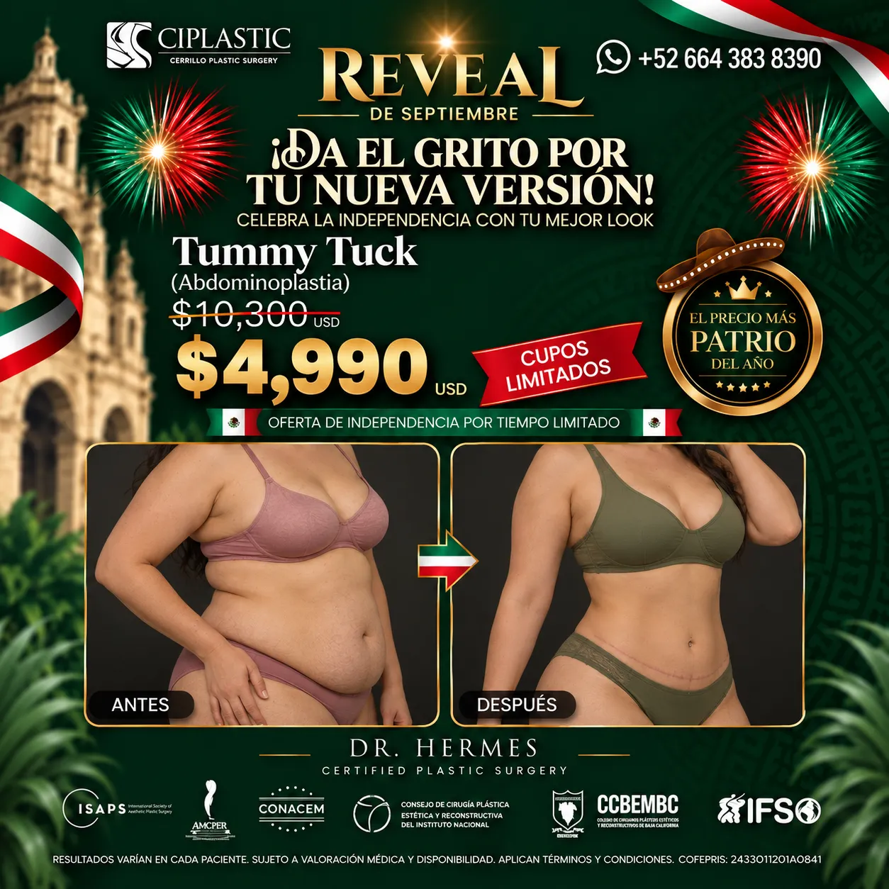 Ciplastic plastic surgery results