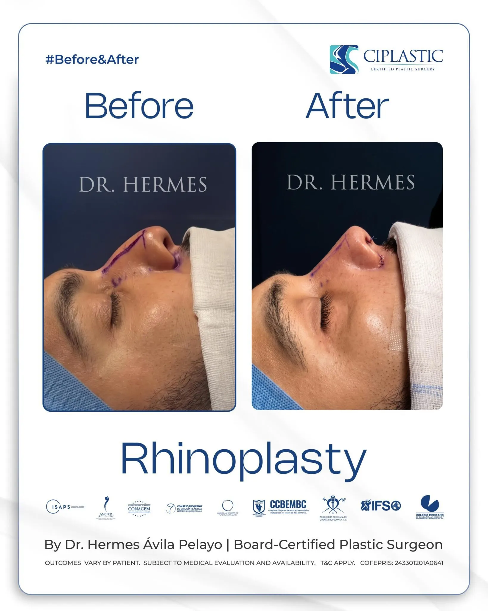 Ciplastic plastic surgery results
